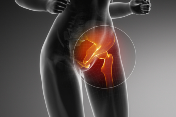 hip conditions and treatments blurb