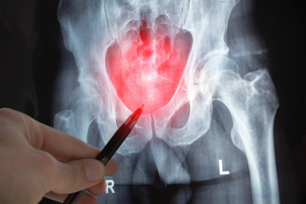 is hip arthroscopy right for you