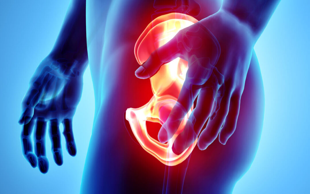 What to Expect After Hip Replacement Surgery?