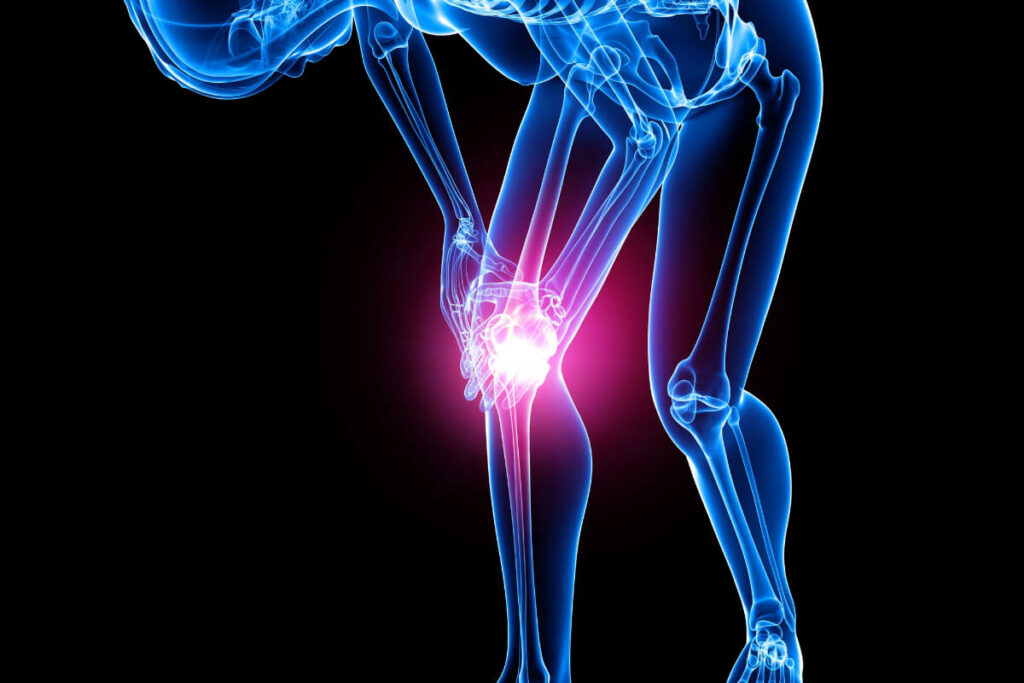 what to expect after knee replacement surgery