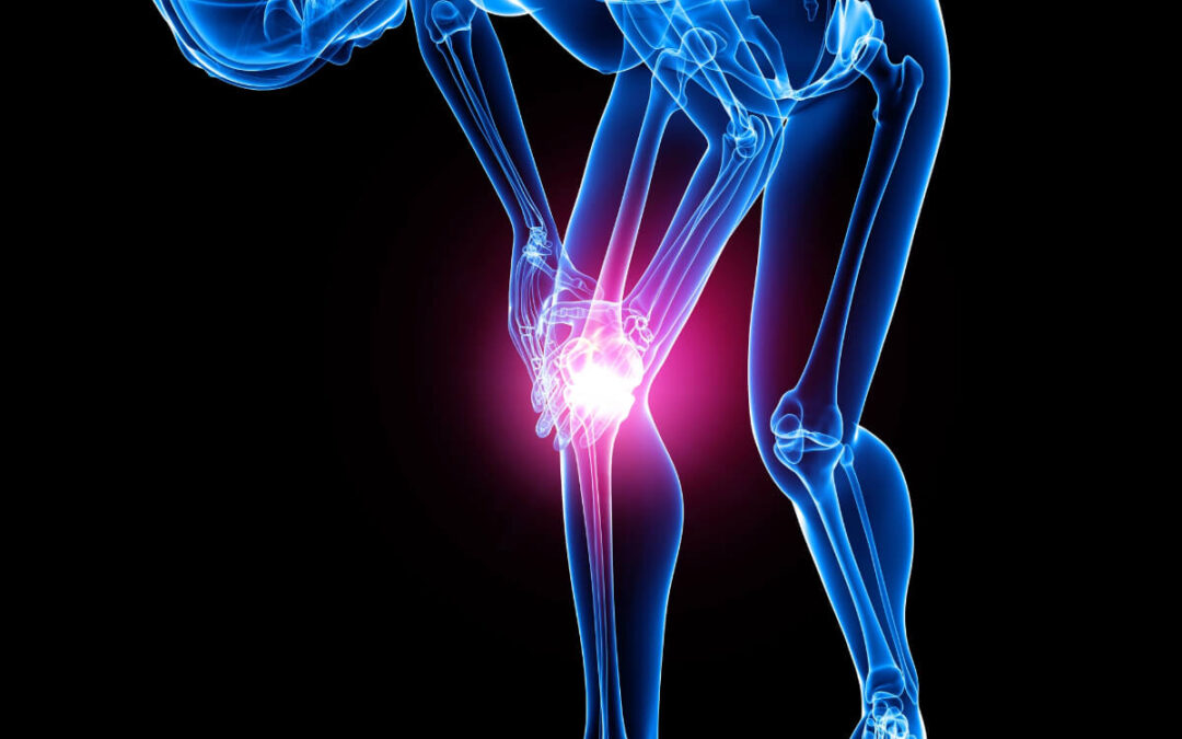What to Expect After Knee Replacement Surgery?