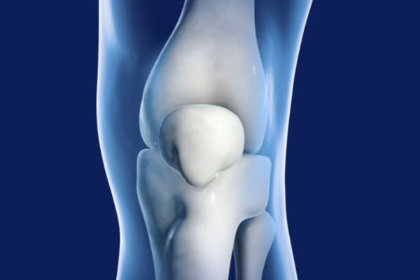 acl repair