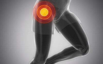 Most Common Reason for Revision Hip Arthroscopy