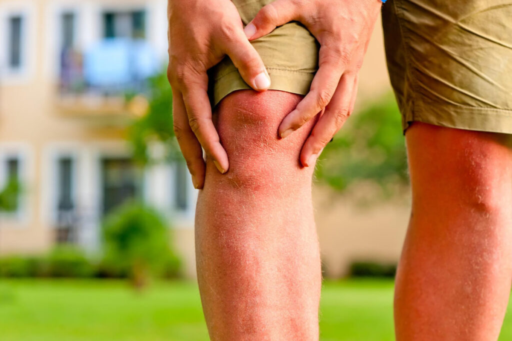 why is my knee clicking after acl reconstruction