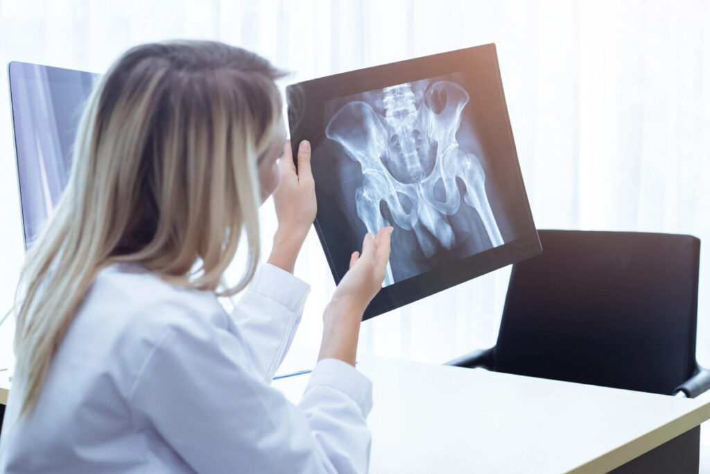 what are the two types of hip impingement