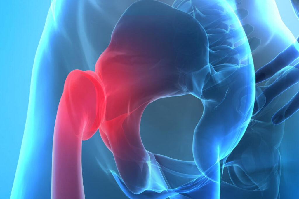 what are the symptoms of hip impingement syndrome